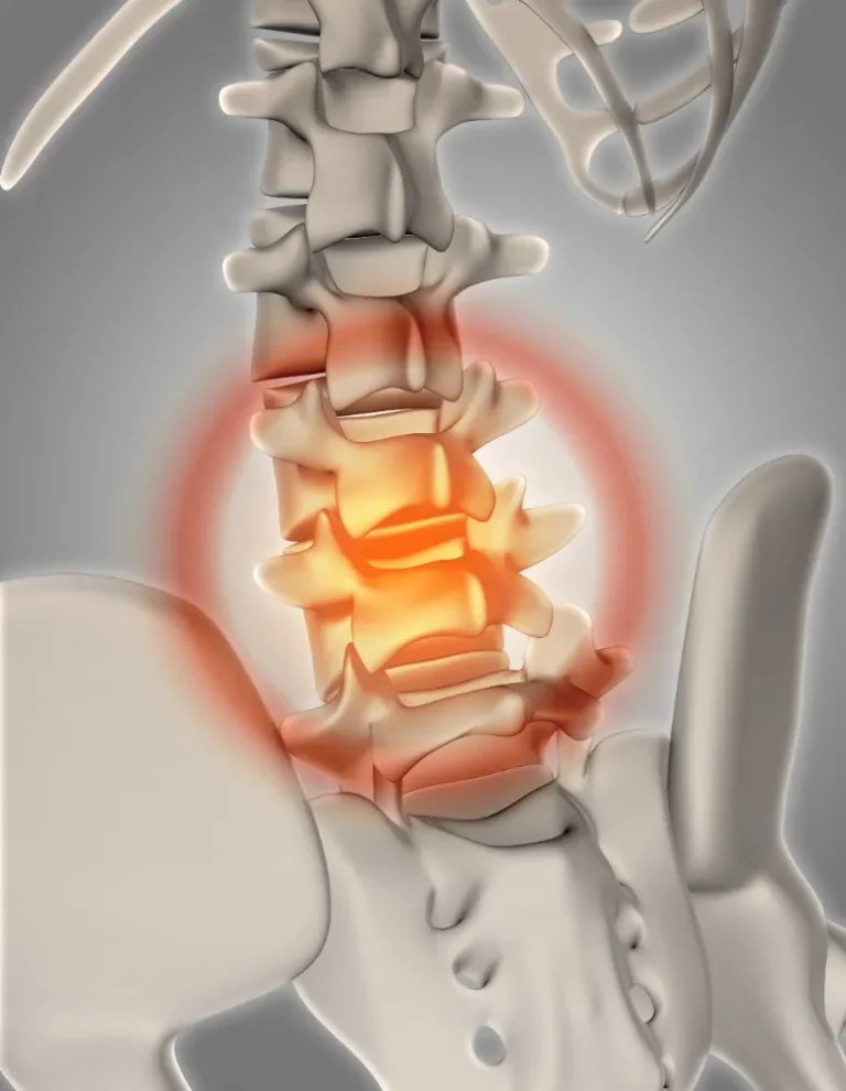 inflam vertebral