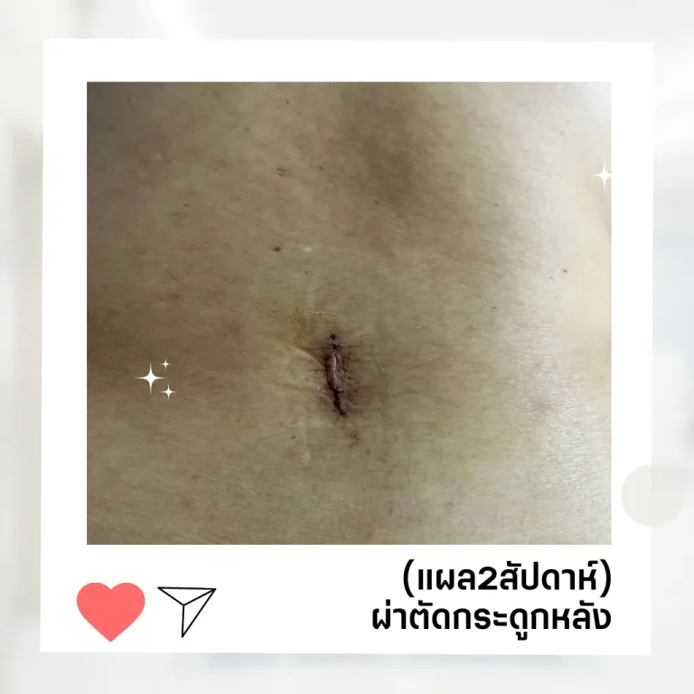 review aspineclinic-5