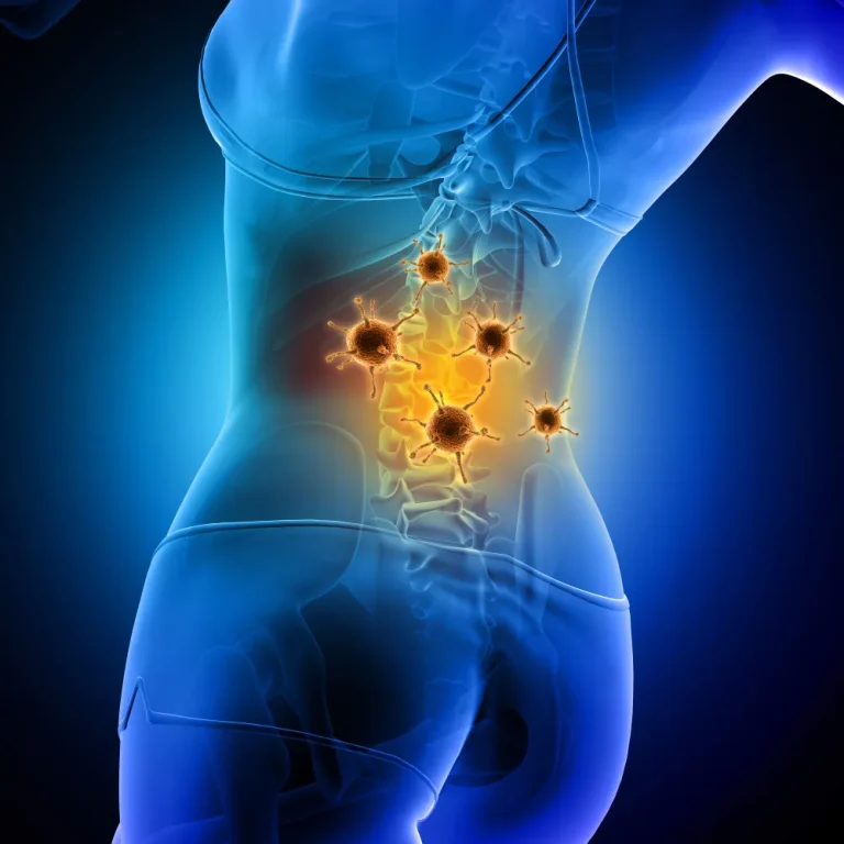 spinal infect