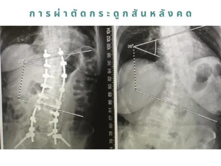 surgery-4