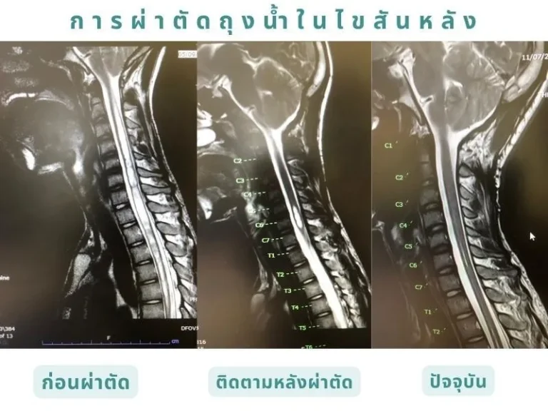 surgery-5