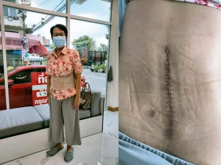 surgery-6