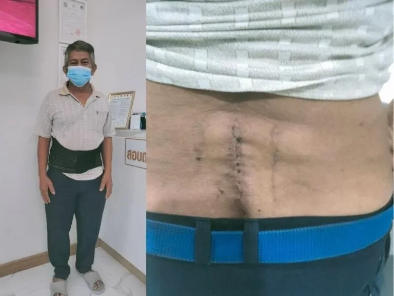 surgery-7